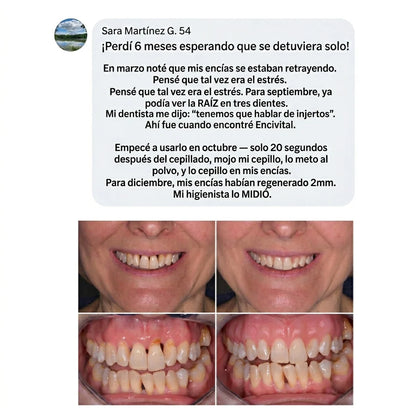 Encías Firmes y Sonrisa Fuerte – Haven Polvo de Colágeno Dental
